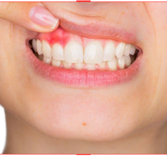 https://sakaryacarkdispoliklinigi.com/wp-content/uploads/2023/10/PERIODONTOLOJI-640x600.png